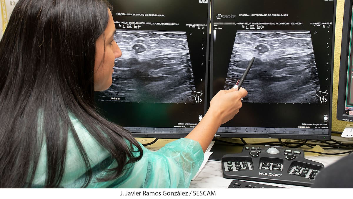 Los gastos 'extra' y la reducción de ingresos: la factura económica y laboral de los pacientes de cáncer - Hora 14 Fin de Semana Aragón (04/02/2024)