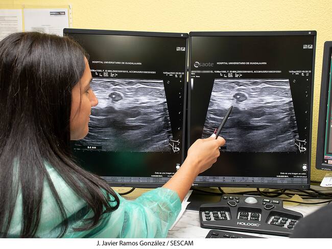Radióloga observando un cáncer de mama