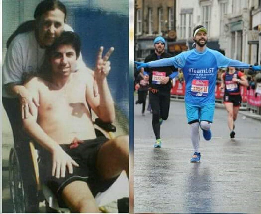 Antes y después de 10 años