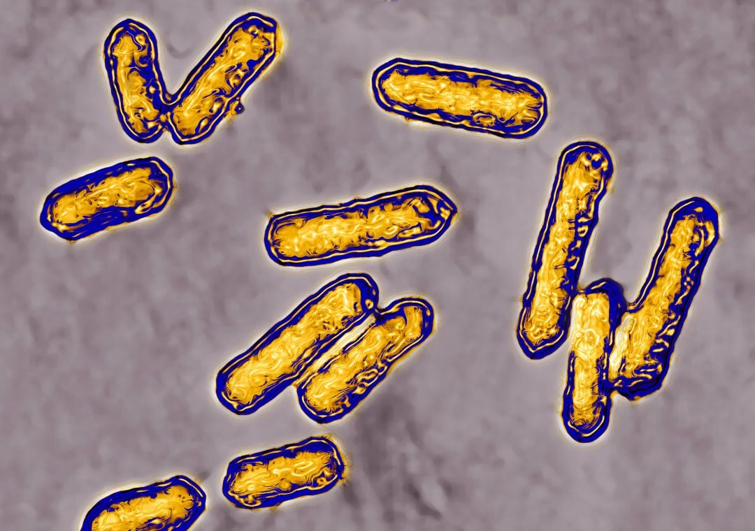 Bacteria &#039;listeria&#039; a vista de microscopio.