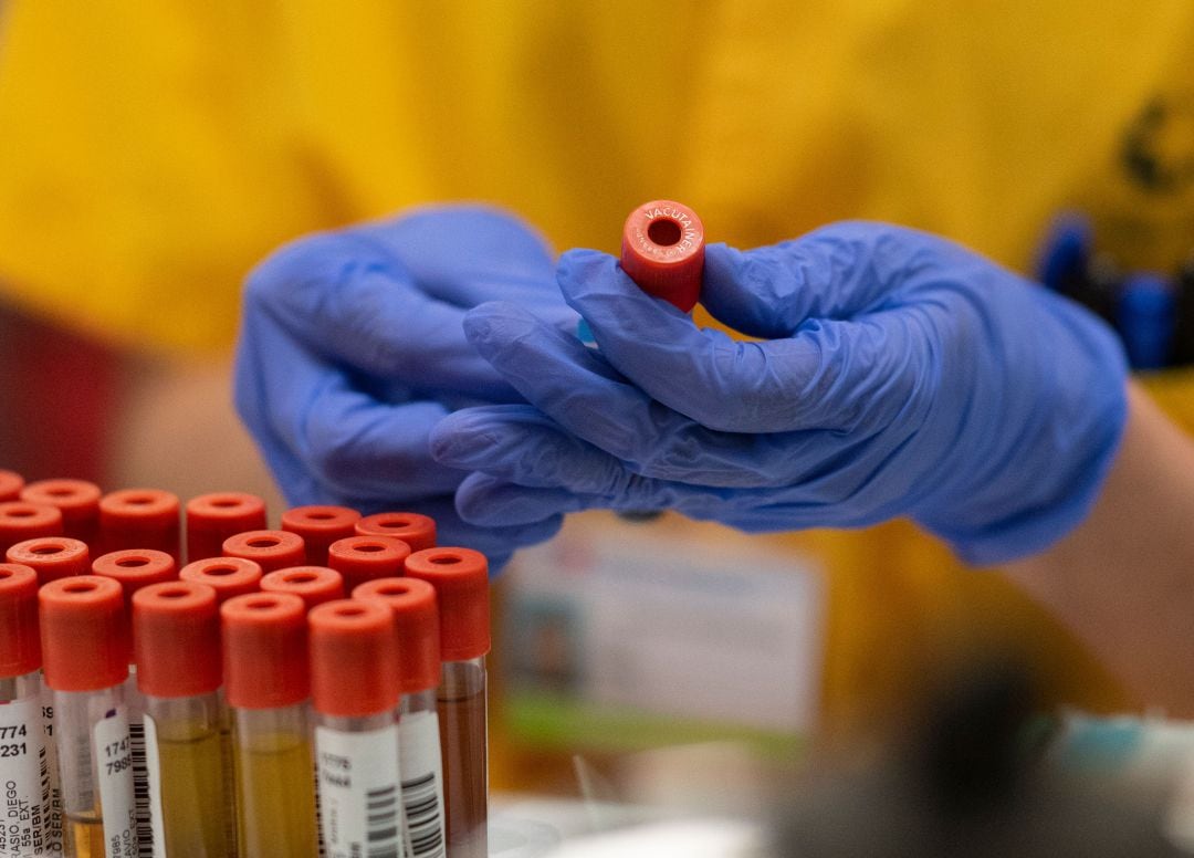 Muestras de PCR en un laboratorio. 