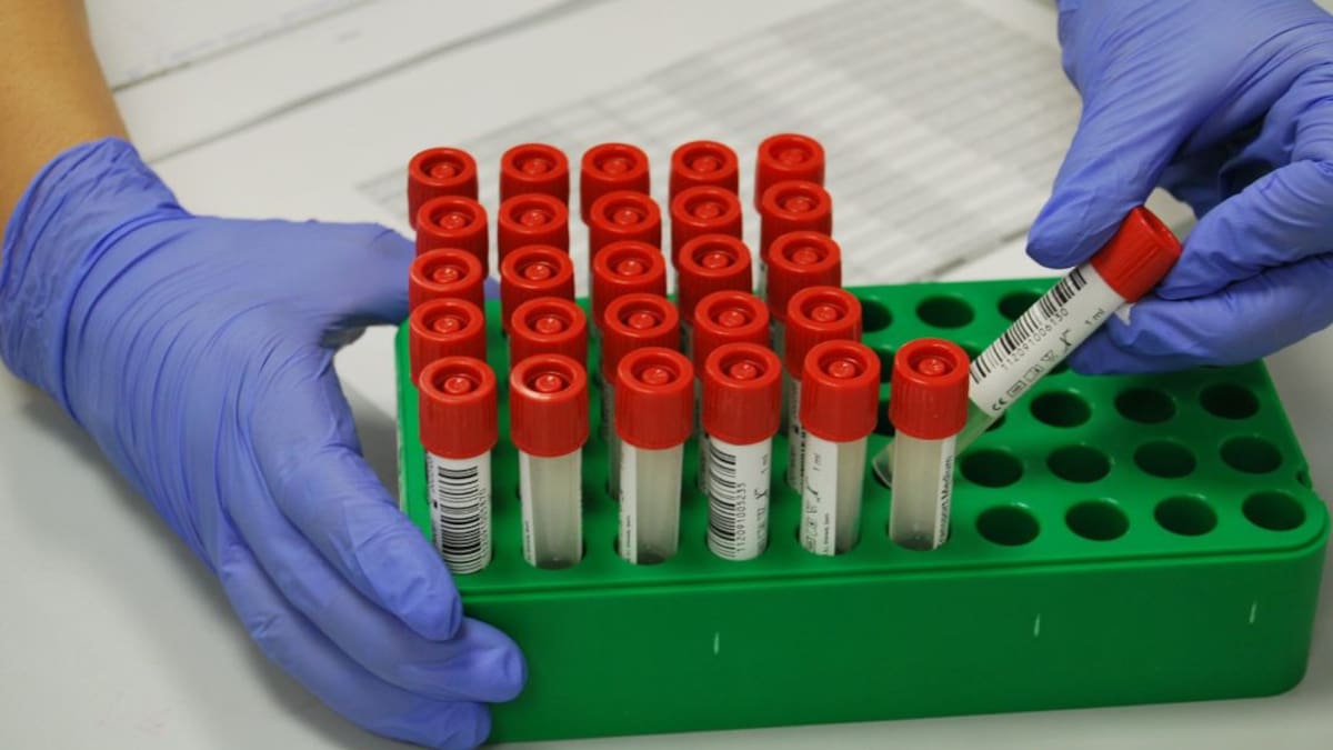 Los cribados del SERGAS, a examen en la SER