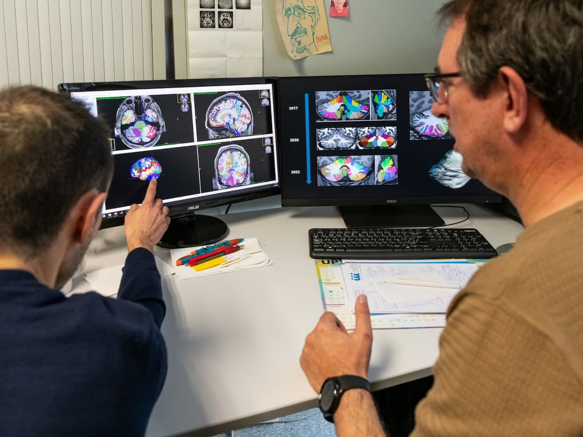 Investigadores de la UPV desarrollan una plataforma que ayuda a mejorar el diagnóstico e investigación sobre epilepsia