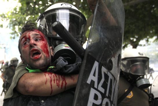 Un manifestante herido y detenido en junio de 2011.