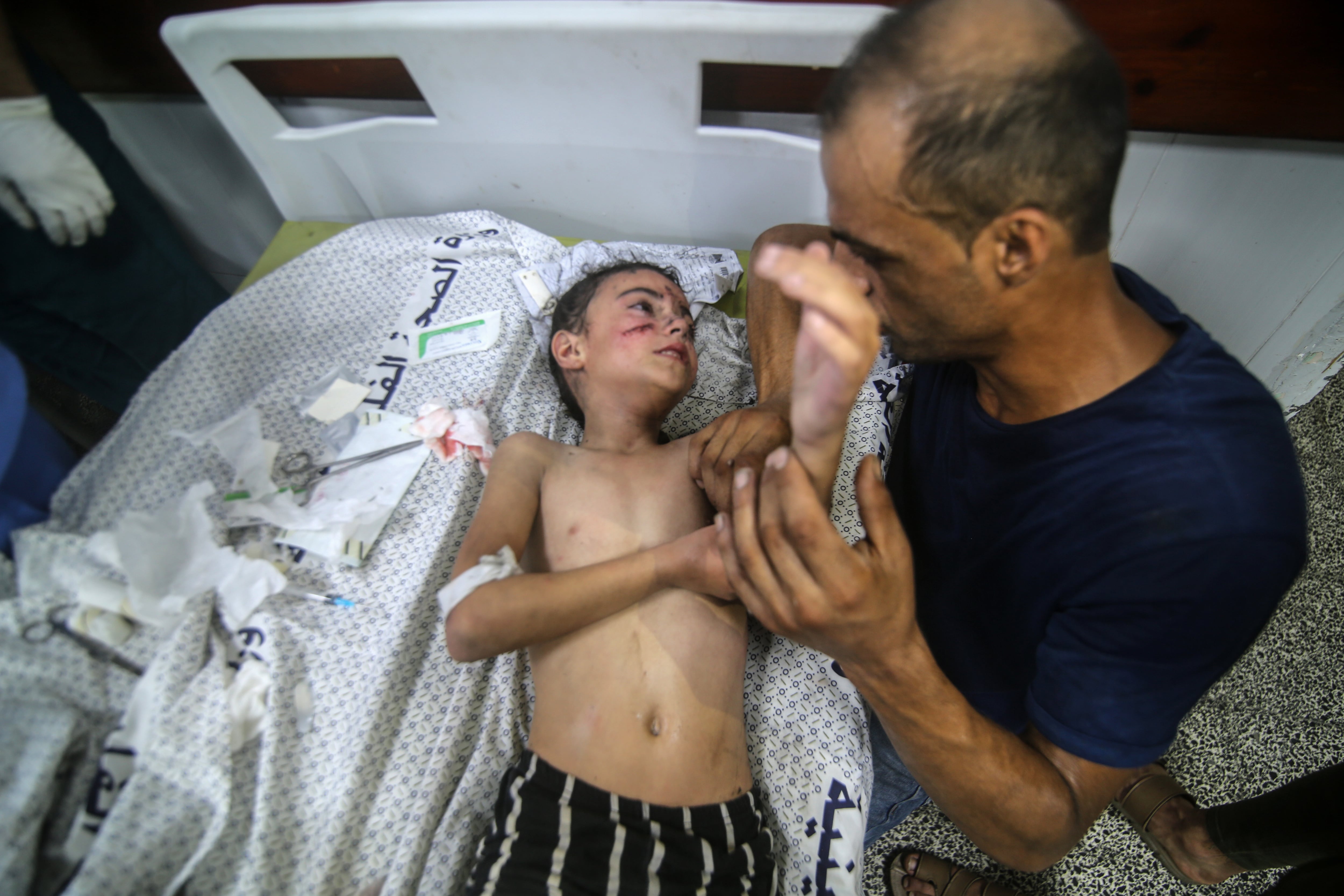 Un niño herido en un bombardeo de Israel espera atención médica en un hospital de Gaza