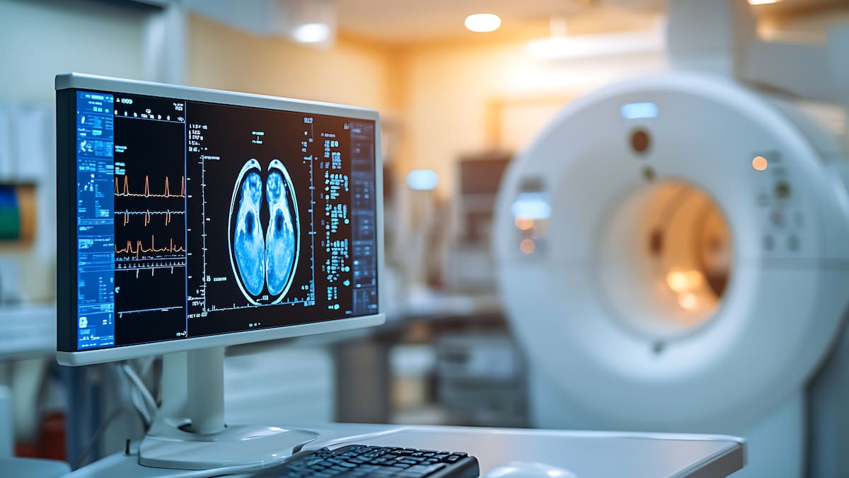 Inteligencia Artificial y computación cuántica para avanzar en el estudio de la ELA