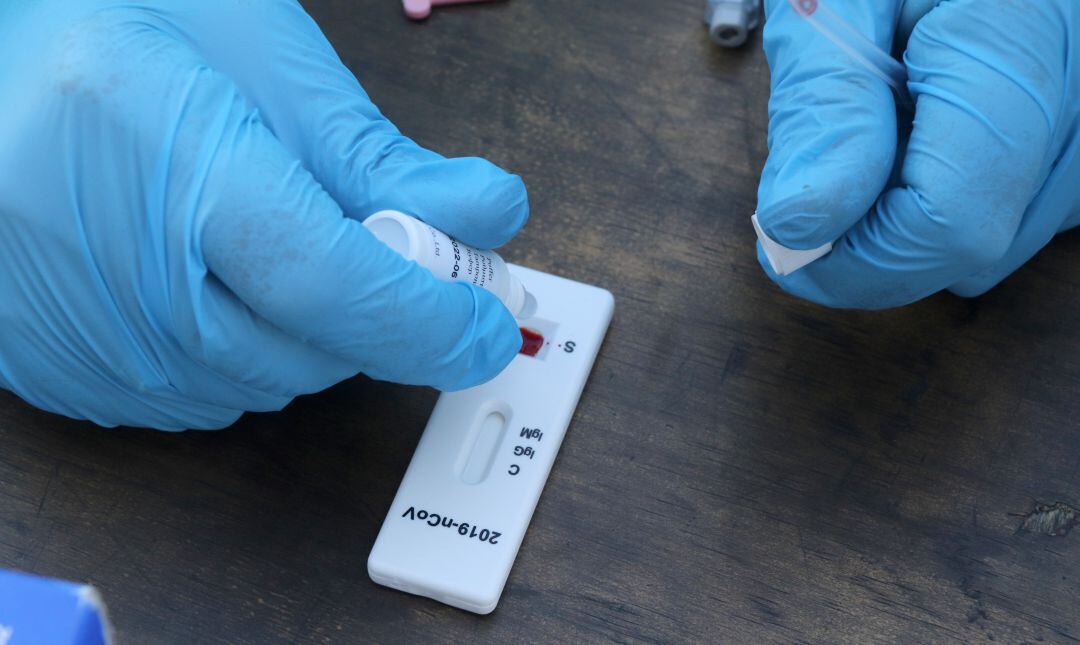 Una infermera fent un test d'antígens