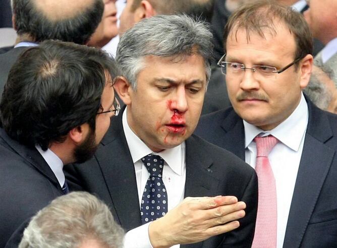 Un diputado con la nariz rota, tras la aprobación de la reforma.
