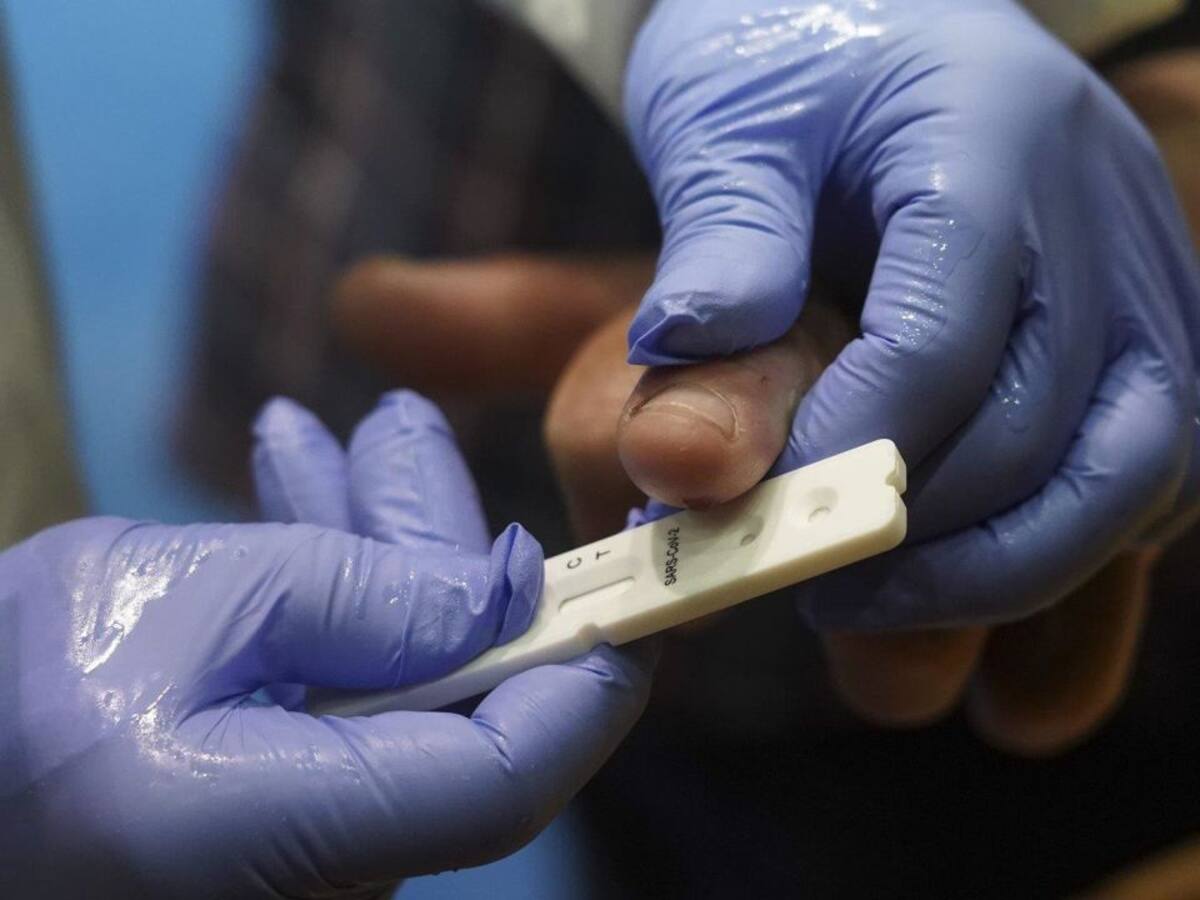 Navarra ha realizado la prueba del COVID-19 al 9% de la población