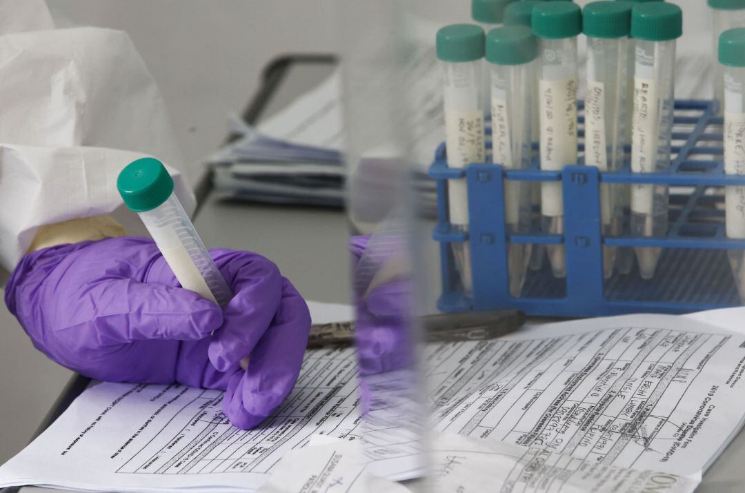 Varias muestras de test para detectar el coronavirus.