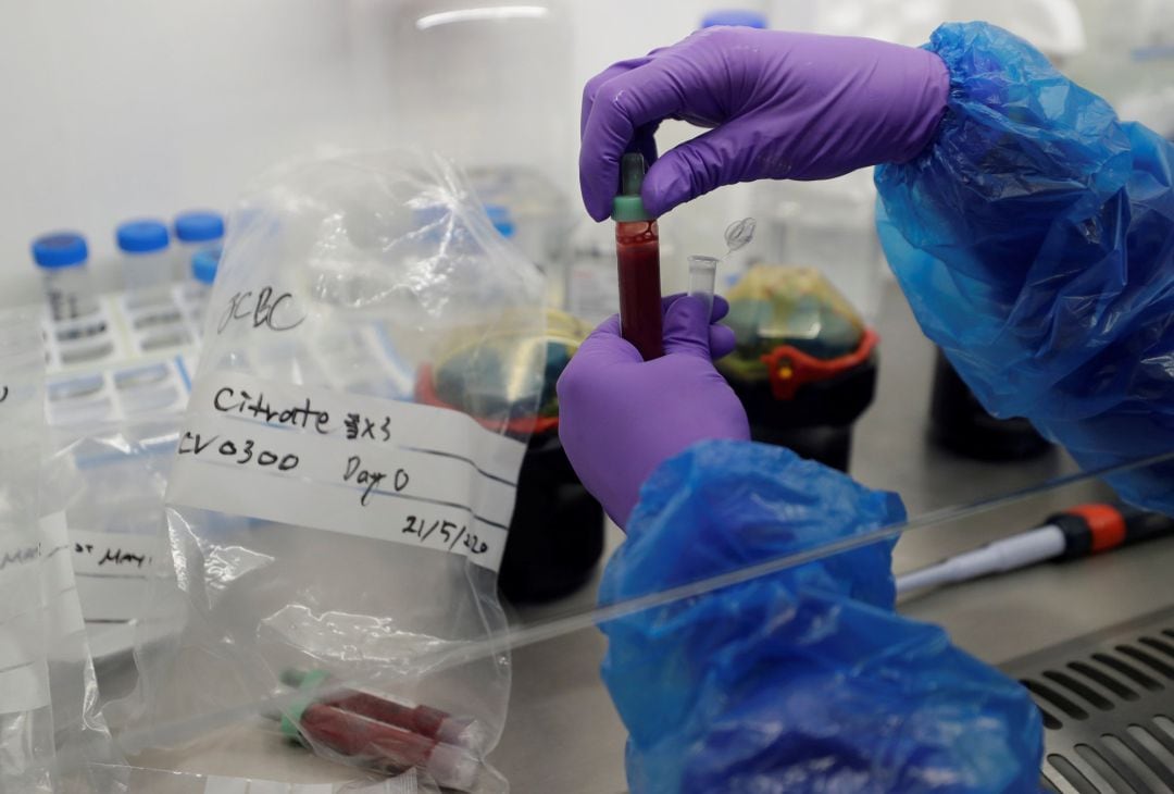 Blood samples from patients infected with the coronavirus disease (COVID-19) are prepared for analysis in the Blood Processing Lab in the Cambridge Institute of Therapeutic Immunology and Infectious Disease, in Cambridge, Britain May 21, 2020