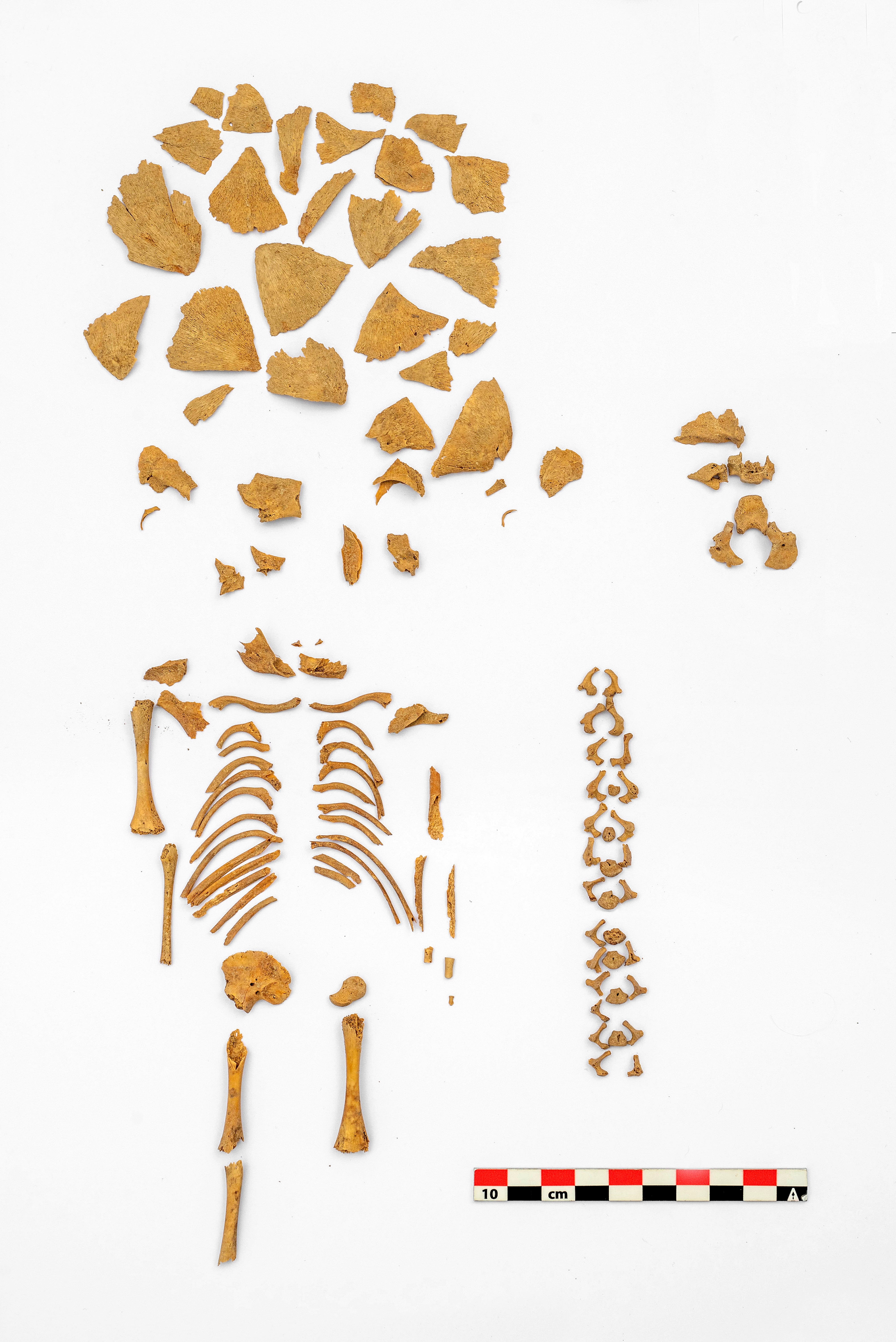 Esqueleto de un niño con síndrome de Down que murió en torno a las 26 semanas de edad gestacional hace 5.000 años.