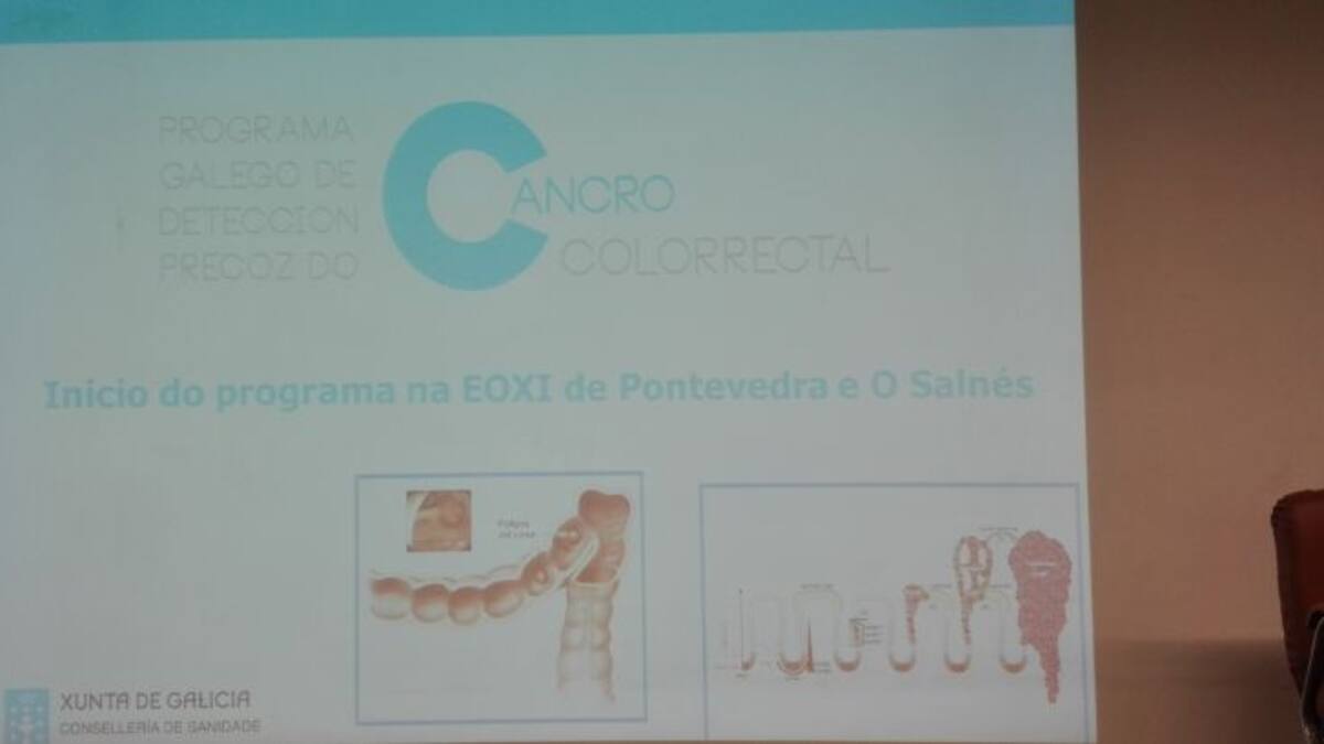 Llega al área sanitaria de Pontevedra y Salnés la detección precoz del cáncer colorrectal