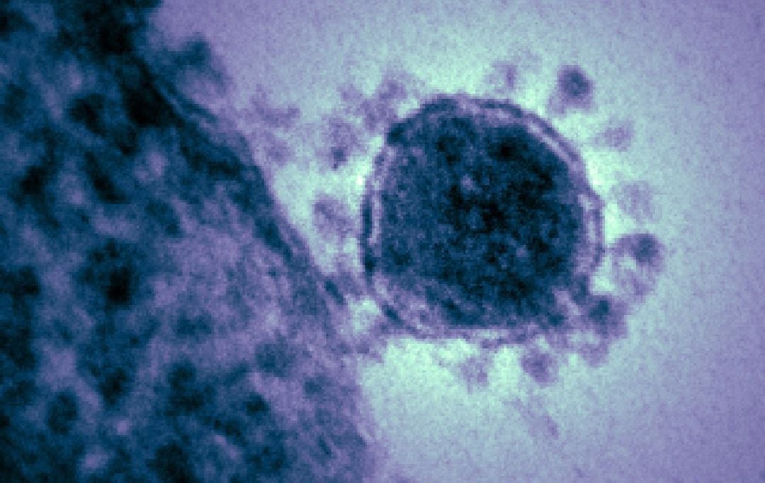 Imagen de archivo de un coronavirus