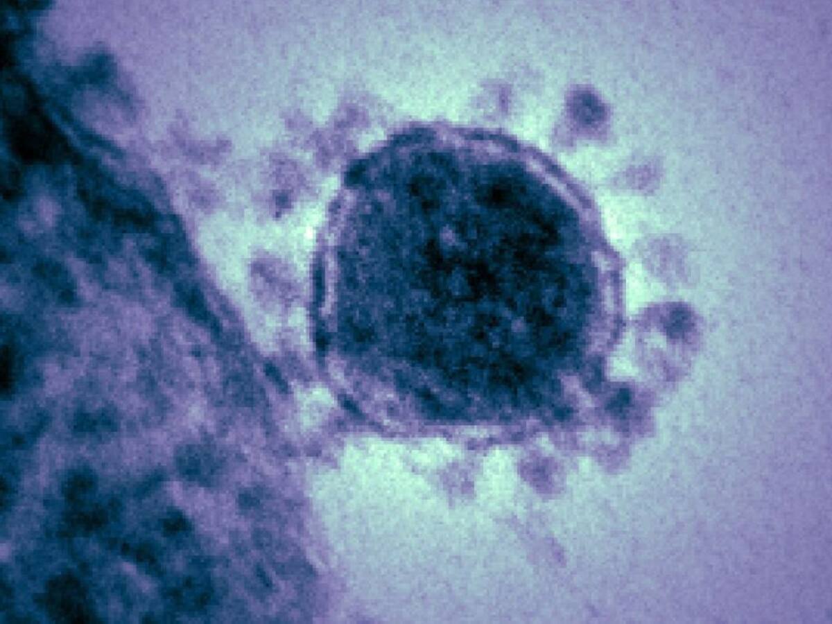 Una joven con síntomas leves, segundo caso de coronavirus en Valladolid