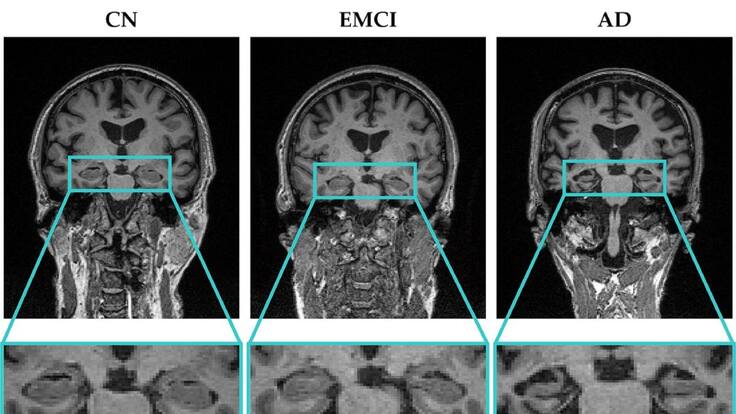 Entrevista en la Ventana al investigador de UPV, David Moratal