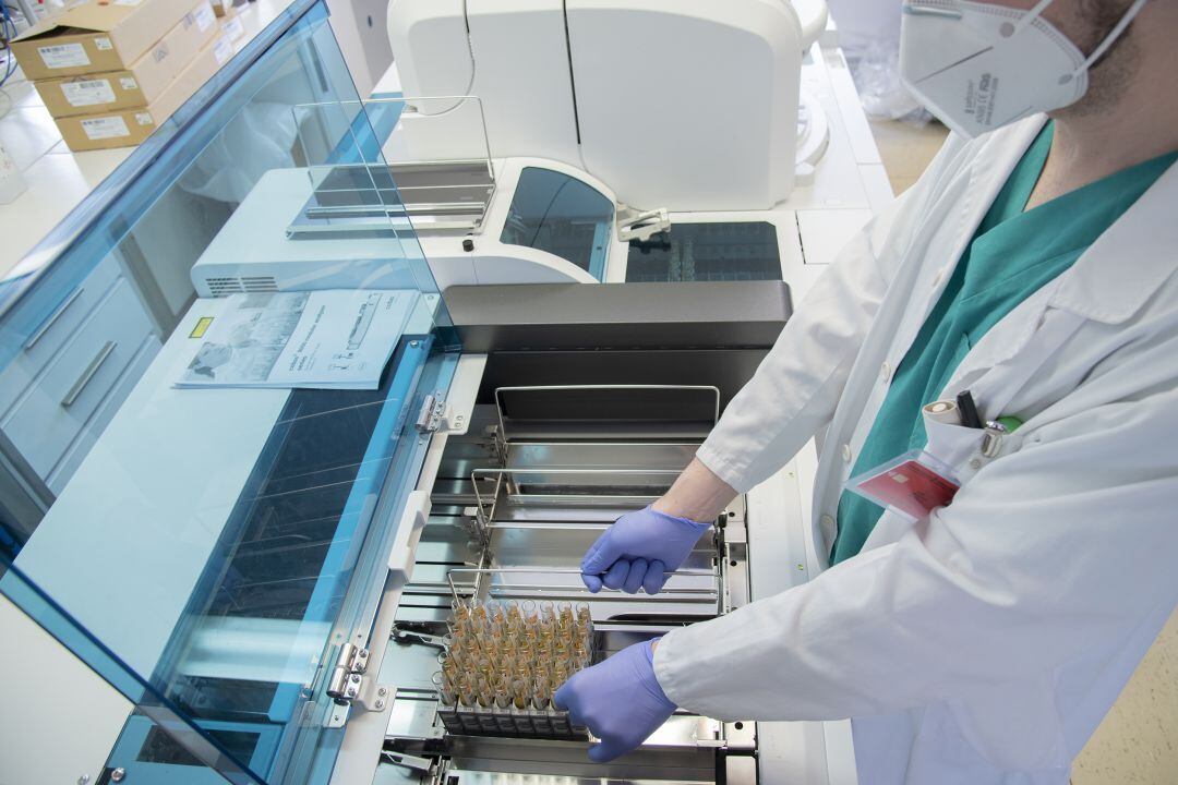 Máquina para detección de anticuerpos por CLIA