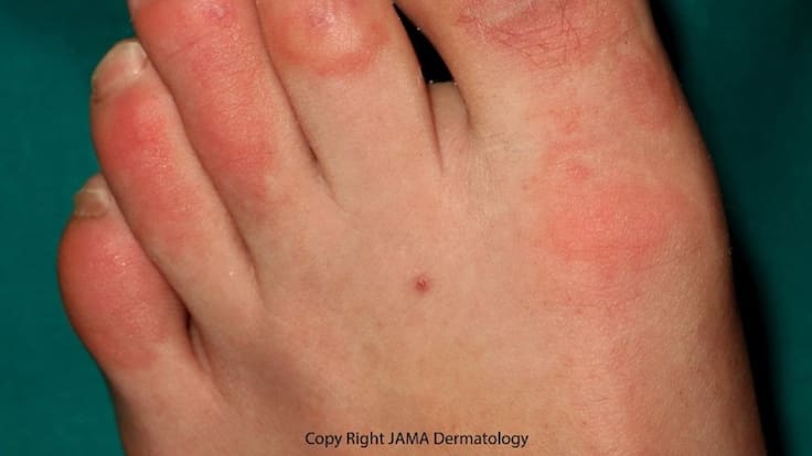 Entrevista a la doctora Juncal Roca