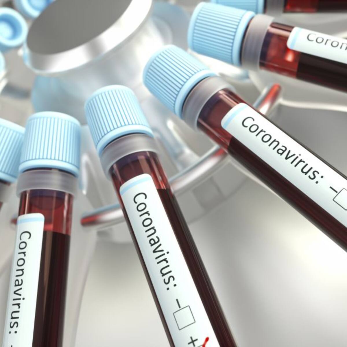 La Región de Murcia registra 67 nuevos positivos en una jornada sin fallecidos por Covid-19