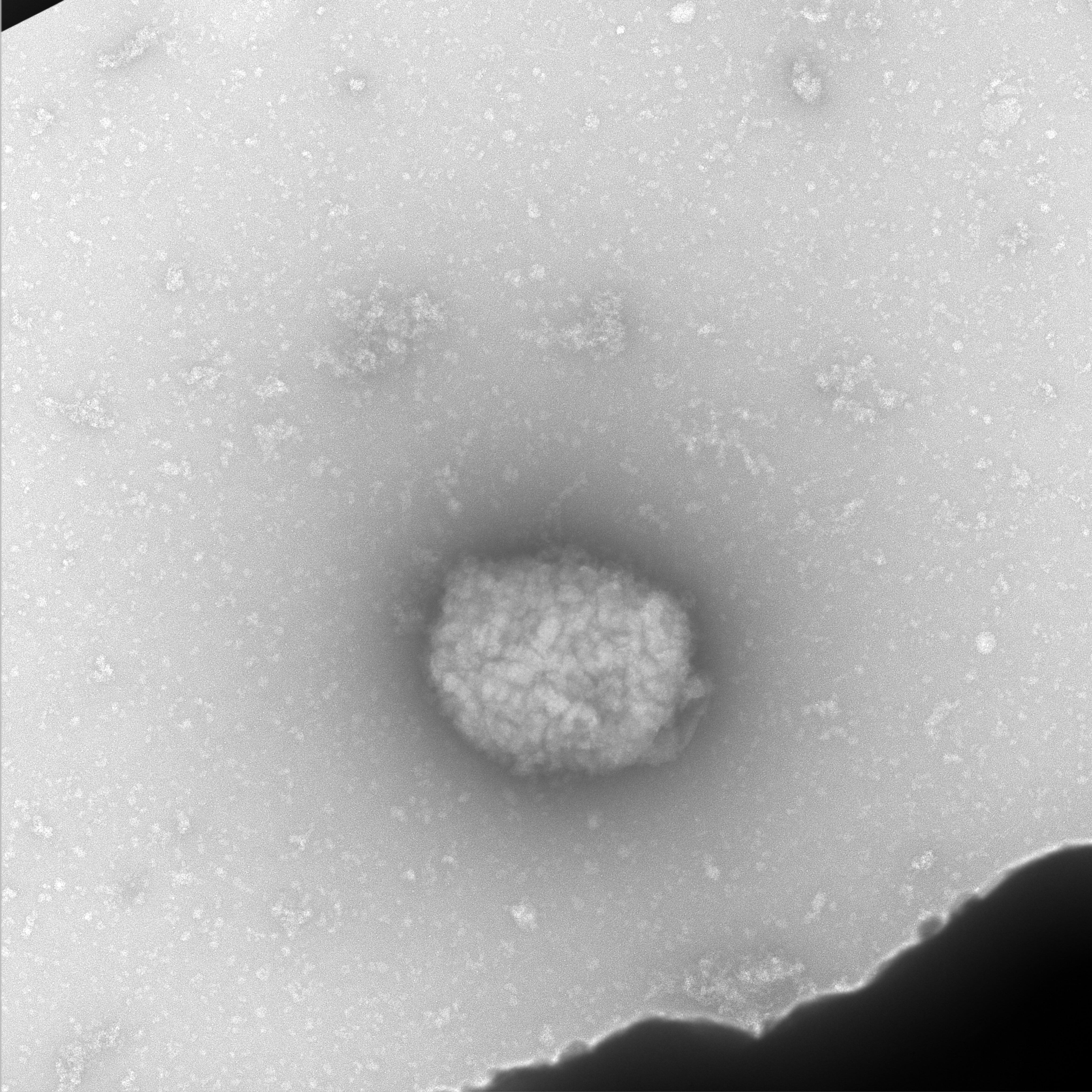 Partículas virales del virus del mono (monkeypox virus) observadas por microscopia electrónica de transmisión directamente del líquido obtenido de pústulas de pacientes infectados.