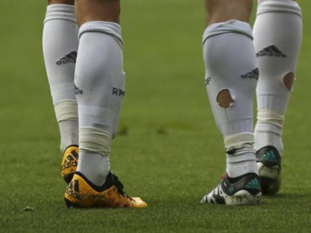 ¿Por qué jugó Bale el partido contra el Celta con agujeros en las dos medias?