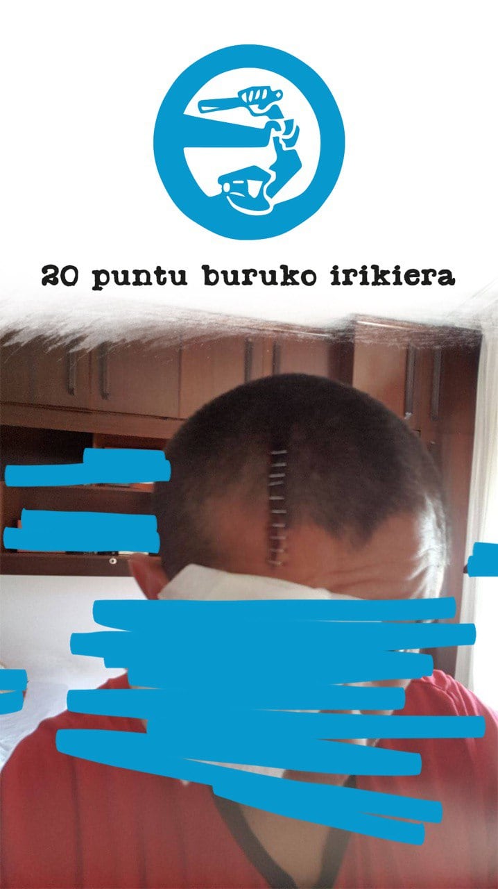 Imagen del golpe en la cabeza de un aficionado de la Real