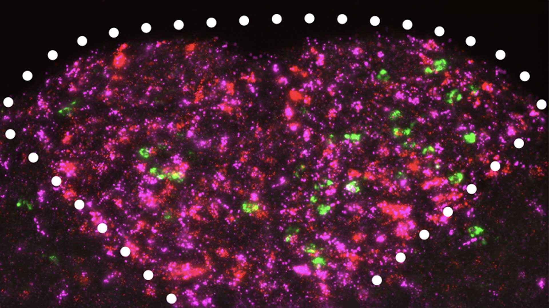 Una nueva investigación del profesor asociado de CSHL Tobias Janowitz, el profesor de medicina de WashU Adam Kepecs y sus colaboradores revela un circuito en el tronco encefálico que puede detectar la inflamación e impulsar un comportamiento similar a la apatía en la caquexia por cáncer.
Crédito
Laboratorio de Kepecs, WashU Medicine / Laboratorio Janowitz, CSHL