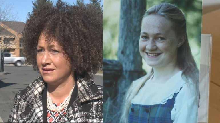 El antes y el después de Rachel Dolezal.