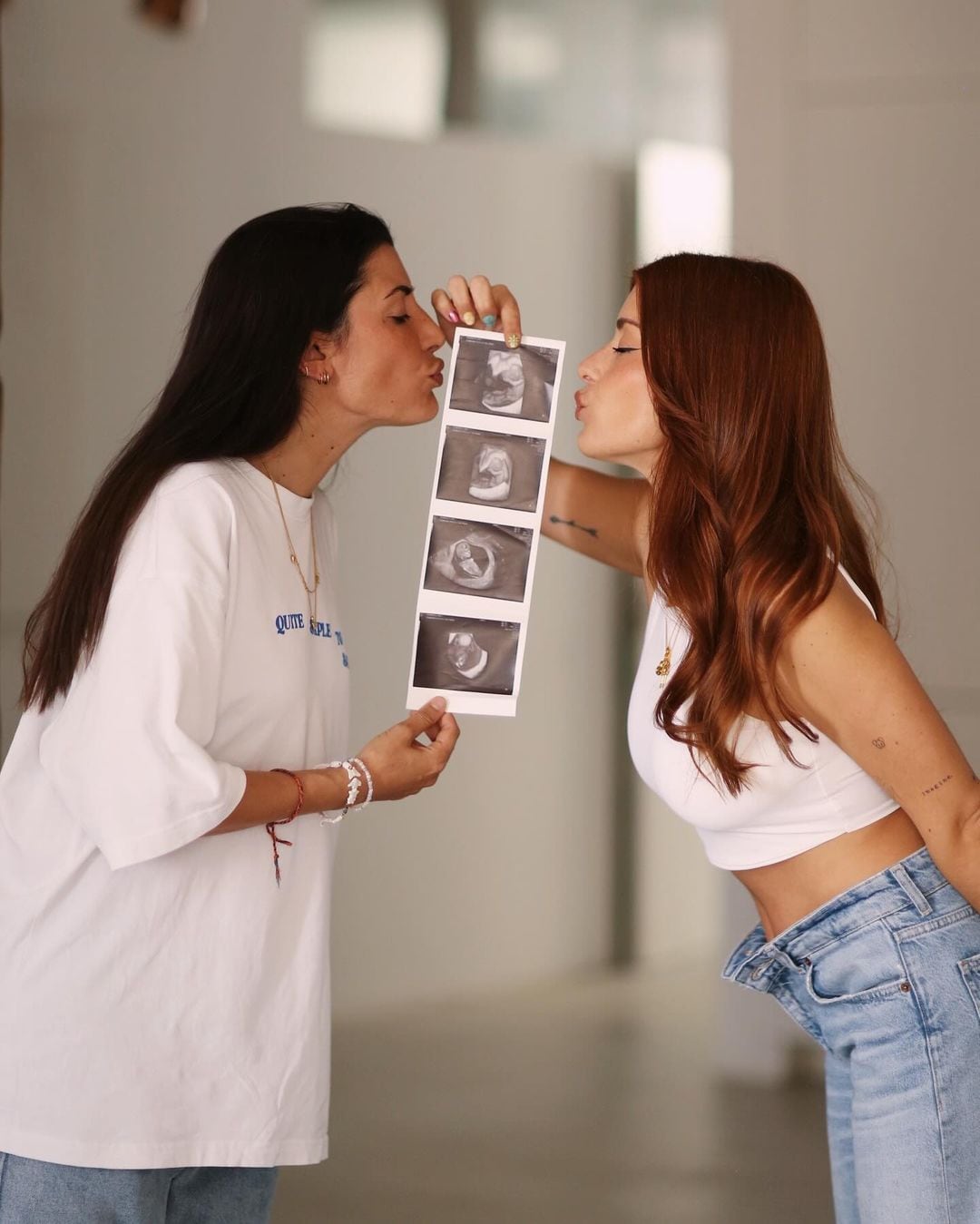 Aida Domenech y Alba Paul junto a la ecografía de su primer hijo