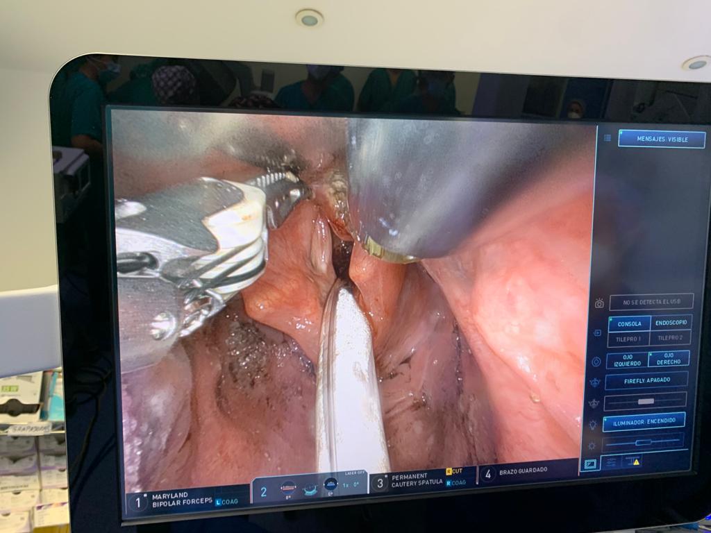 Cirugía robotica otorrinolaringología