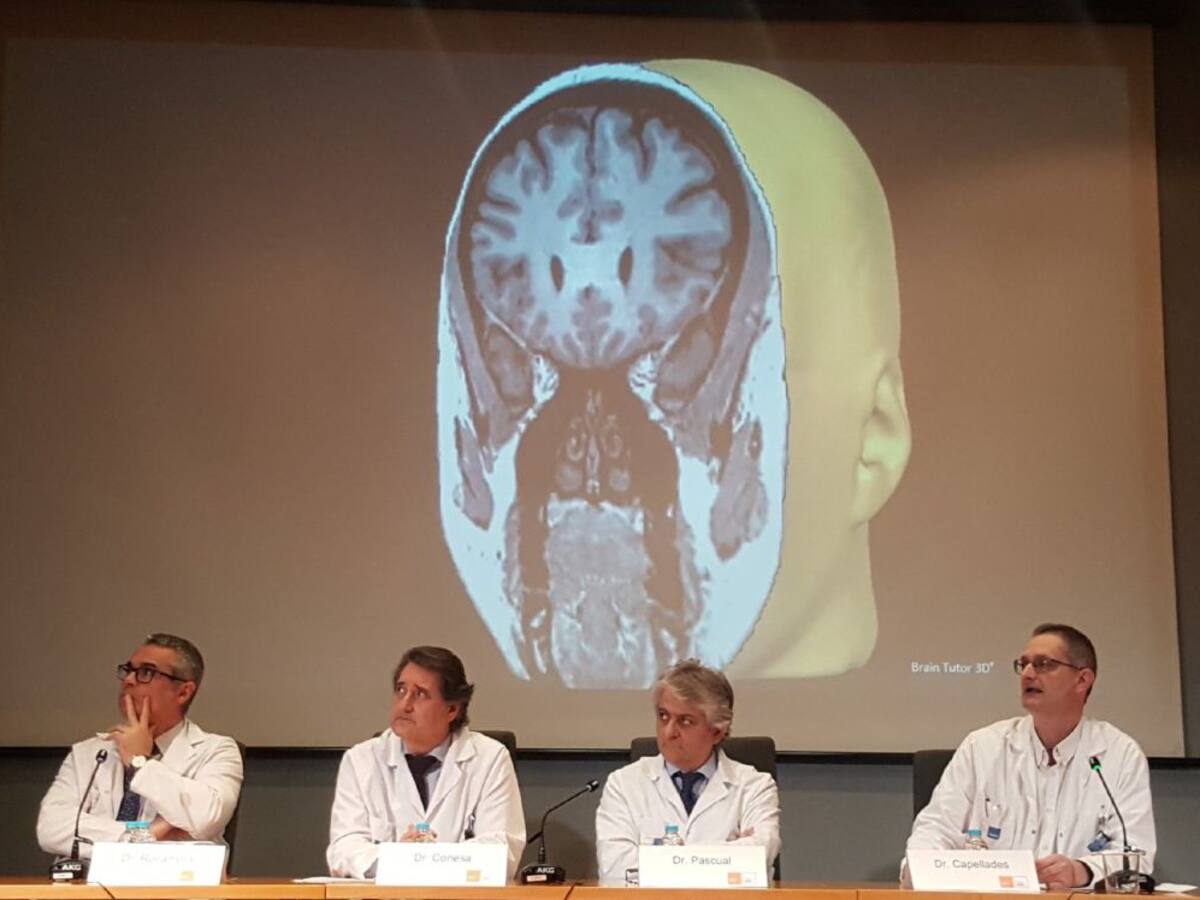 Primera cirurgia làser a l'Estat per tractar l'epilèpsia i tumors cerebrals
