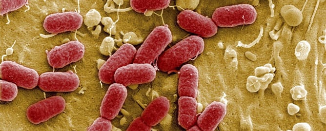 Archivo sin fechar facilitada por el Centro de Investigación de Infecciones Helmhotz de una imagen tomada mediante un telescopio electrónica una bacteria EHEC, una cepa de la bacteria &#039;Escherichia coli&#039; de alta resistencia a los antibióticos, en Braunschw