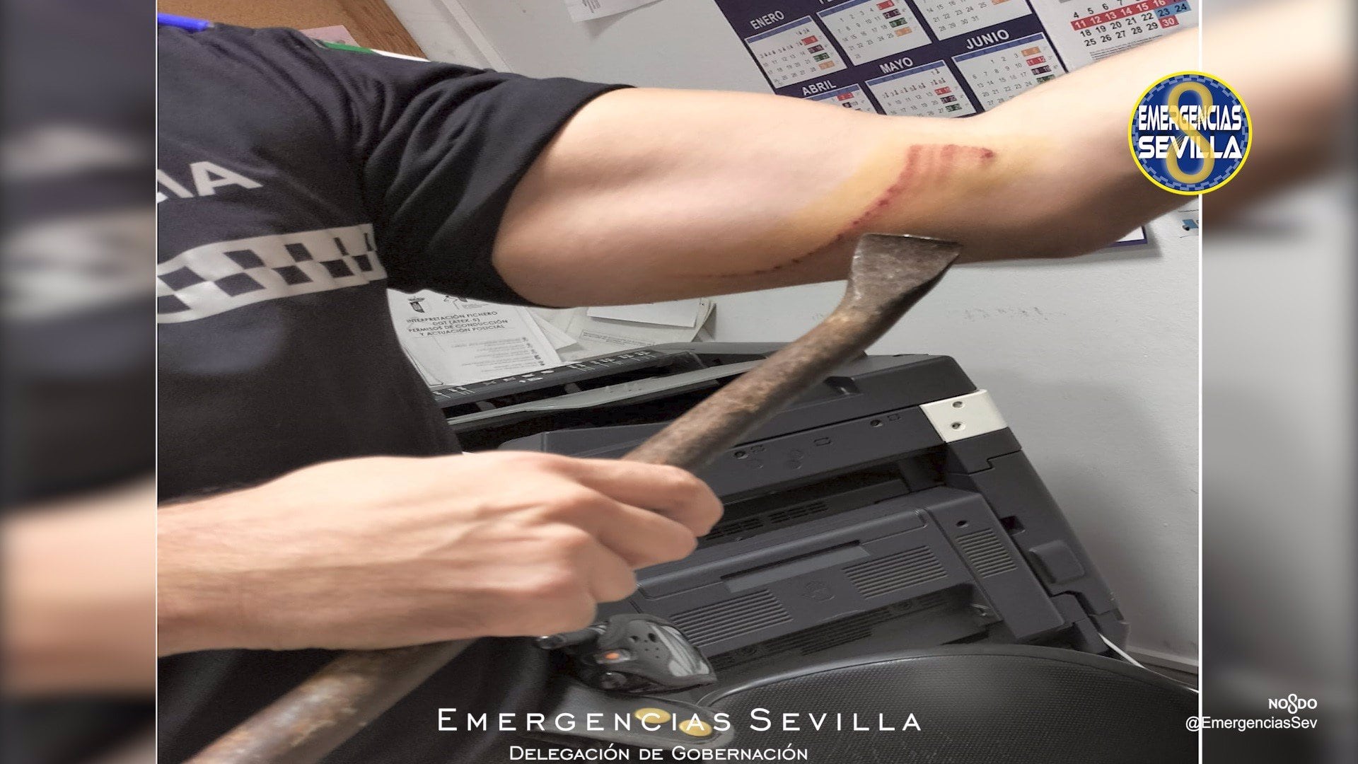 Herida en el brazo del agente alcanzado por la palanqueta.