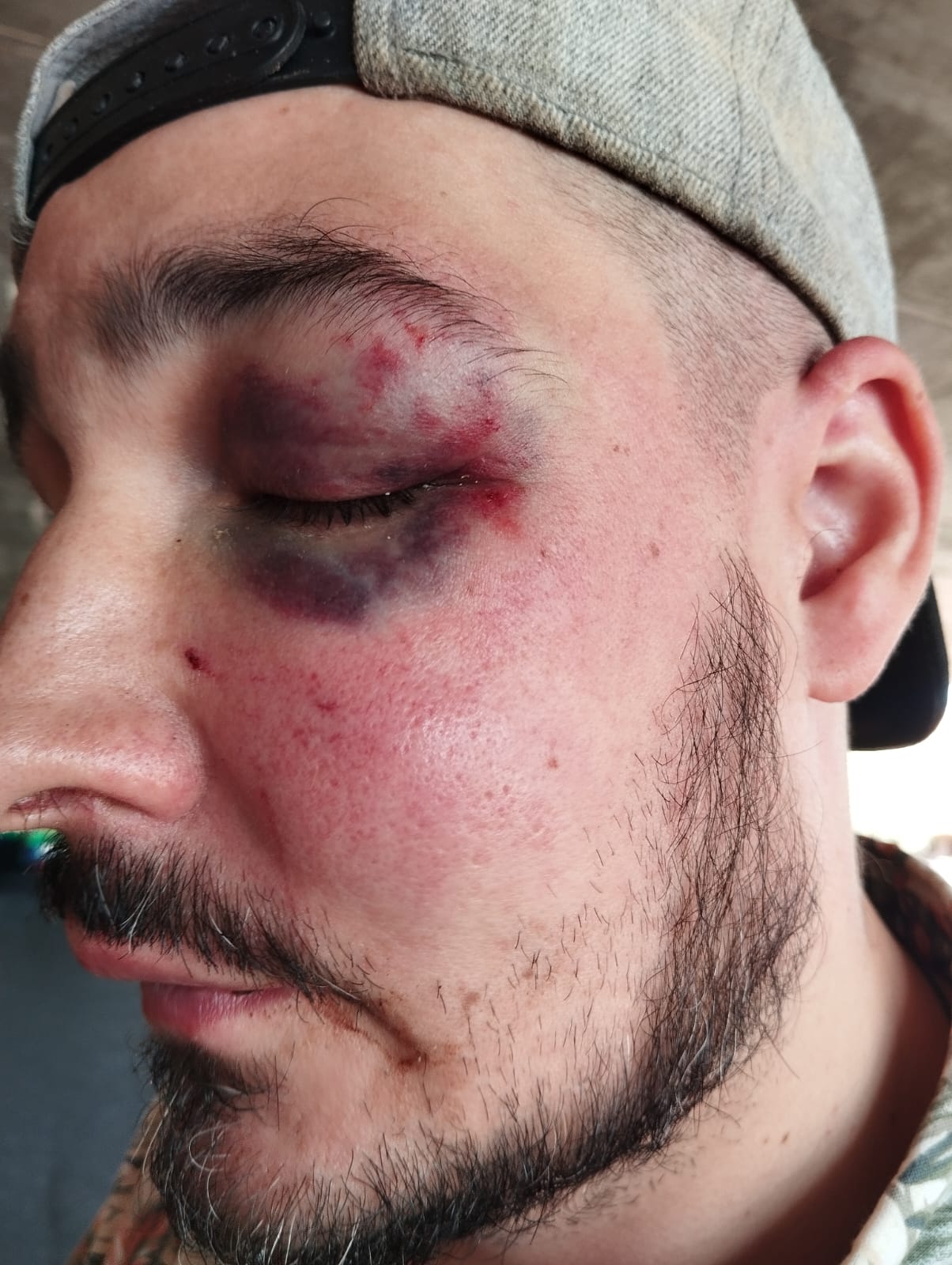 Una de las dos víctimas de la presunta agresión neonazi en Talavera