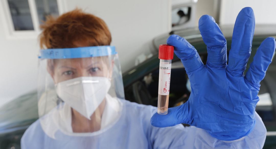 Muestra de una prueba realizada a un paciente