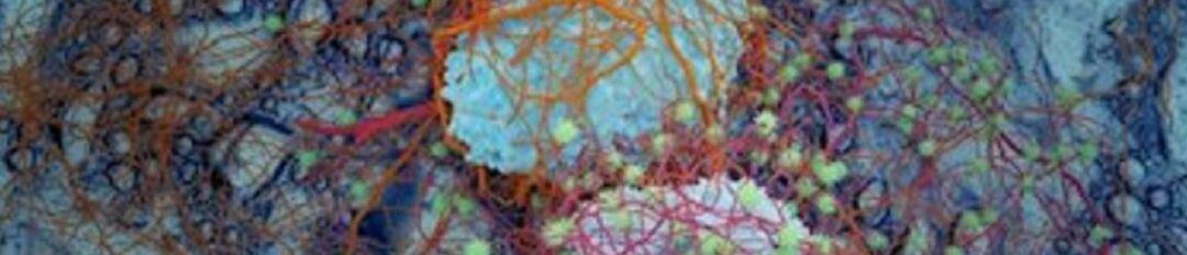 Uclm investiga nuevos fármacos contra tumores resistentes a la quimio convencional