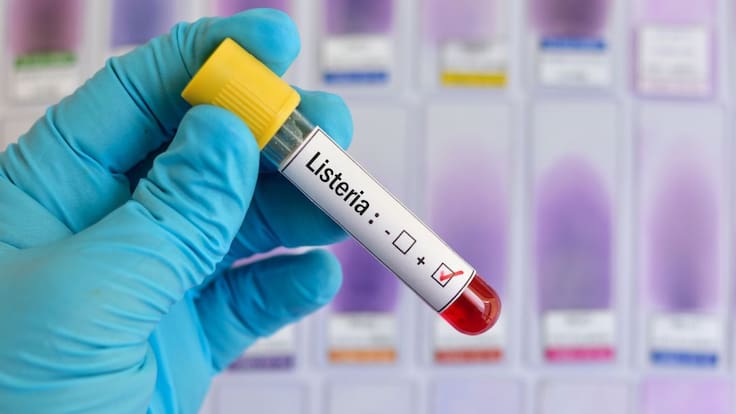 "Mi madre falleció por listeriosis, y a mi hermano, que comió la misma carne, no quieren hacerle la prueba"