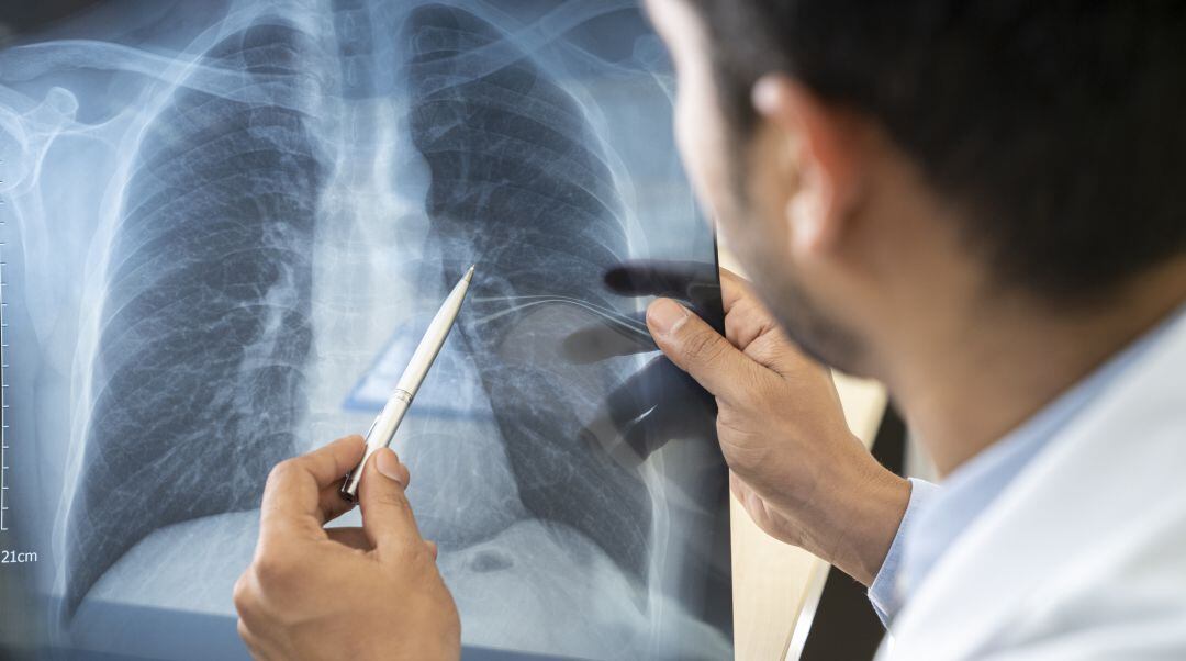 Un médico con una radiografía de unos pulmones