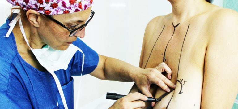 Una operació d&#039;elevació de pit no comporta, obligatòriament, la implantació de pròtesis