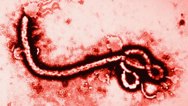 Virus del Ébola.