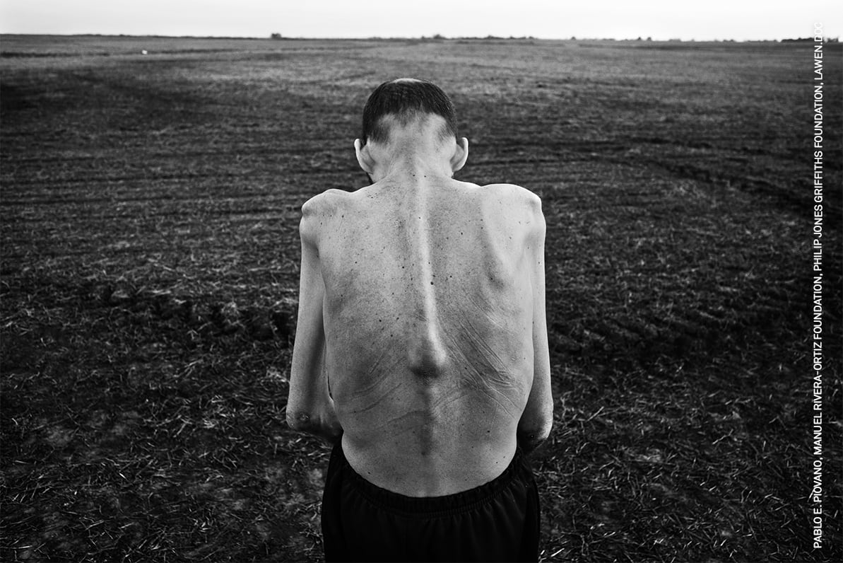 'El costo humano de los agrotoxinas', la fotografía premiada en World Press Photo 2026 en la categoría de Proyectos a Largo Plazo de la región Sudamérica.