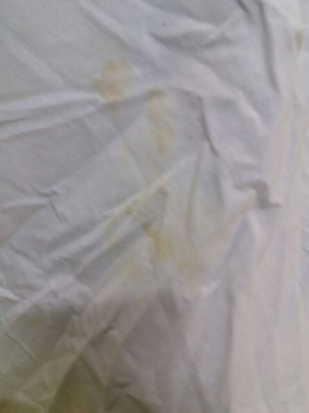 Manchas de orina en las sábanas después de pasar por lavanderia en Hospital Gral. de Castellón