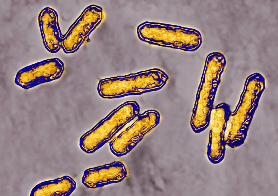 Bacteria de la listeria