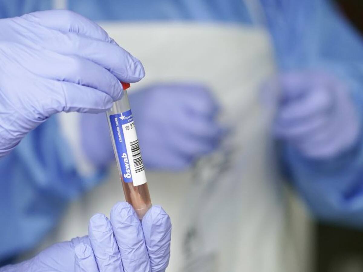 Castilla y León suma otros 68 casos confirmados por PCR