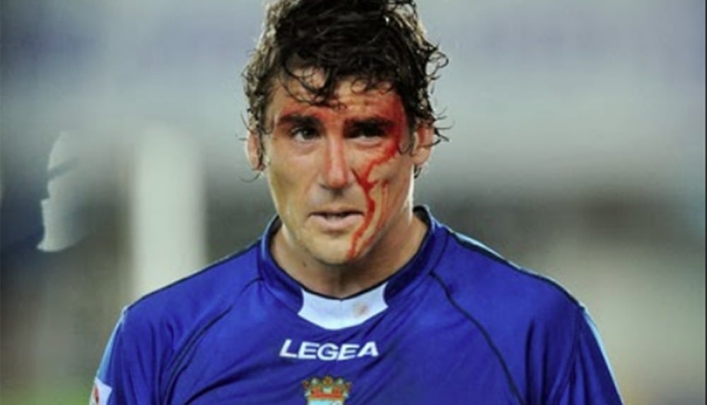 Mario Bermejo se partió la cara por el Xerez CD