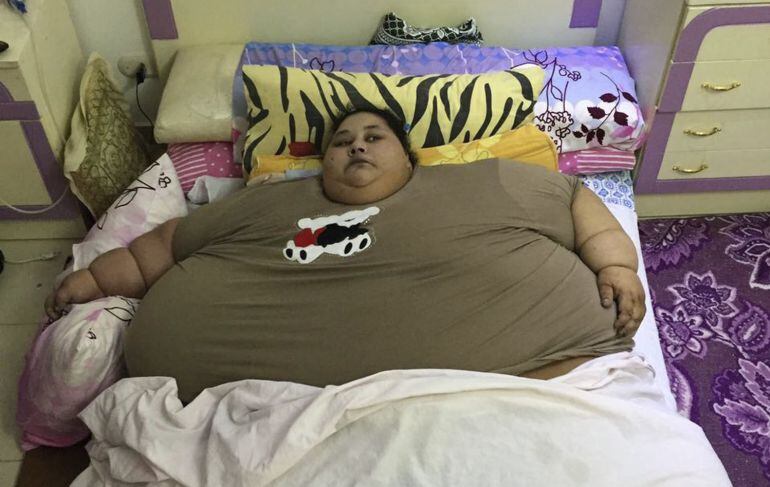 Fotografía facilitada por la familia este 15 de diciembre de la egipcia Eman Ahmed, quien se cree es la mujer más obesa del mundo, en su casa en Alejandría (Egipto).