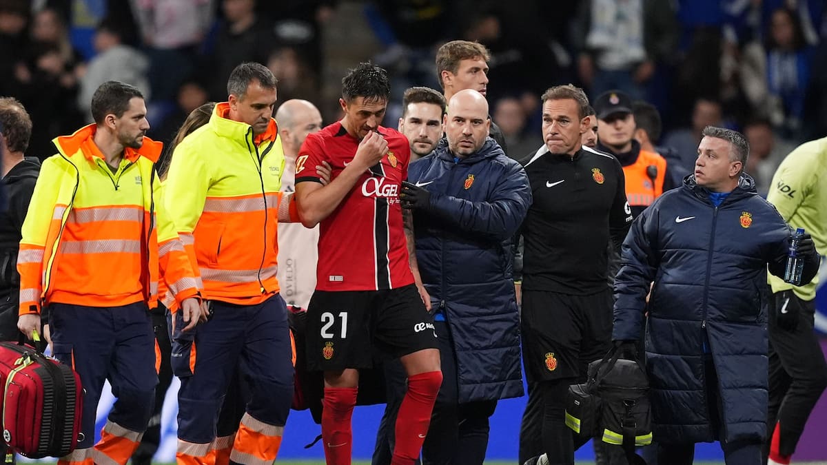 Antonio Raíllo operado con éxito de la fractura de pómulo