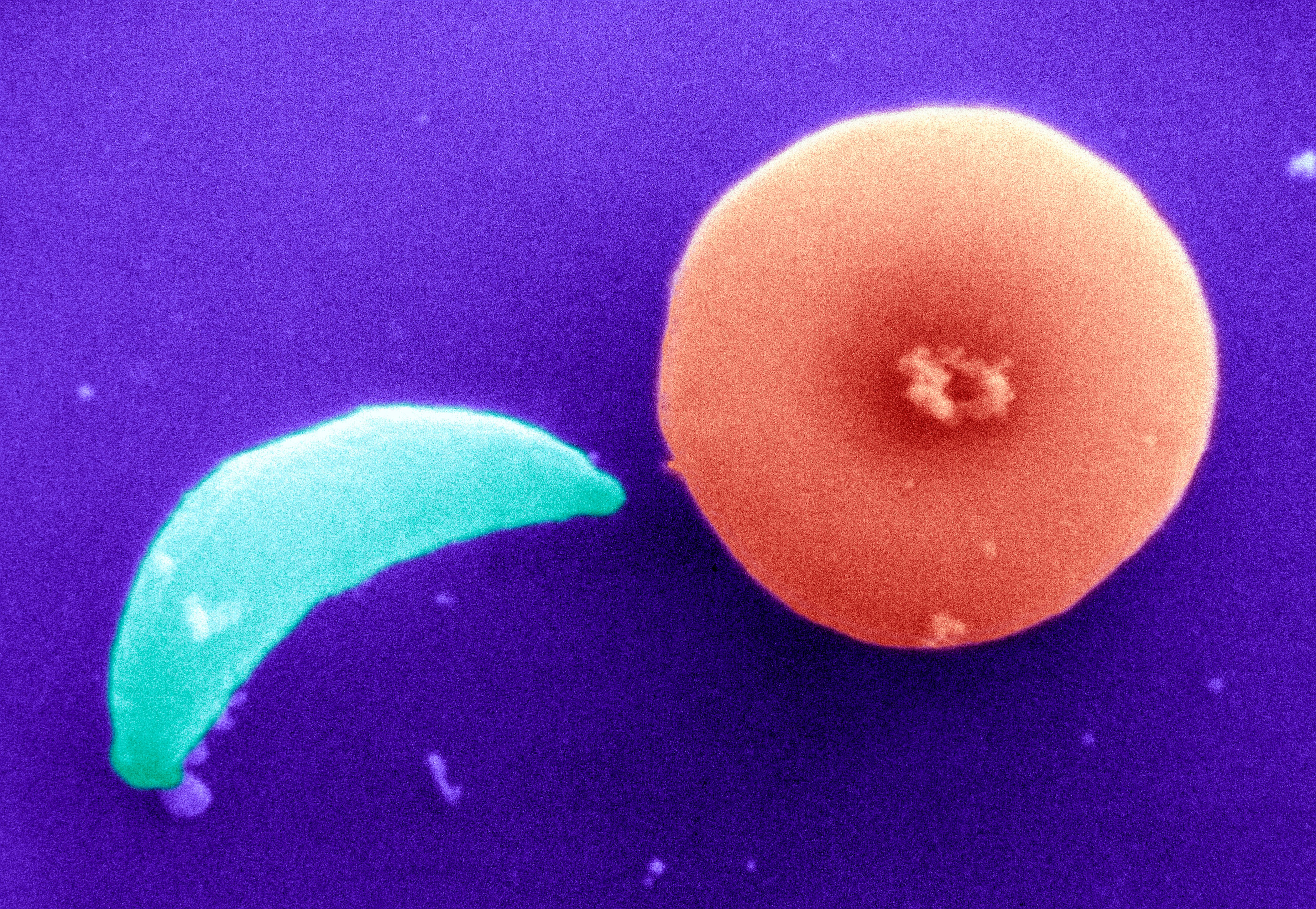 Una foto de archivo del Toxoplasma Gondii (Photo By BSIP/UIG Via Getty Images)