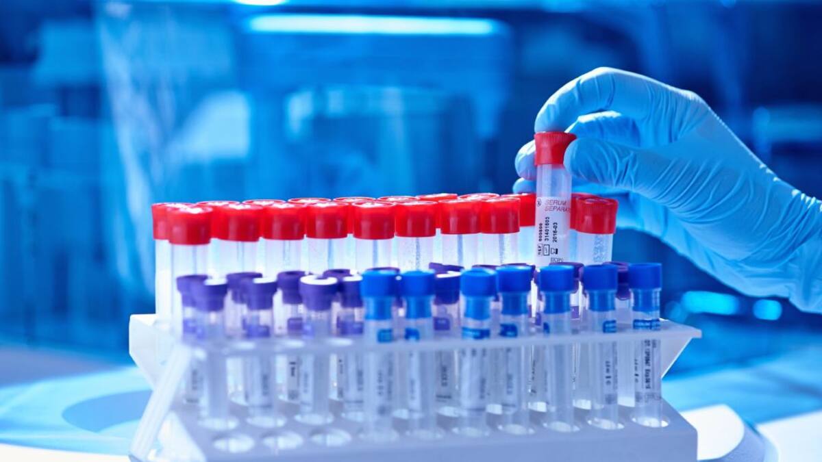 En incremento los contagios en Linares y provincia, con 7 nuevas muertes por Covid-19