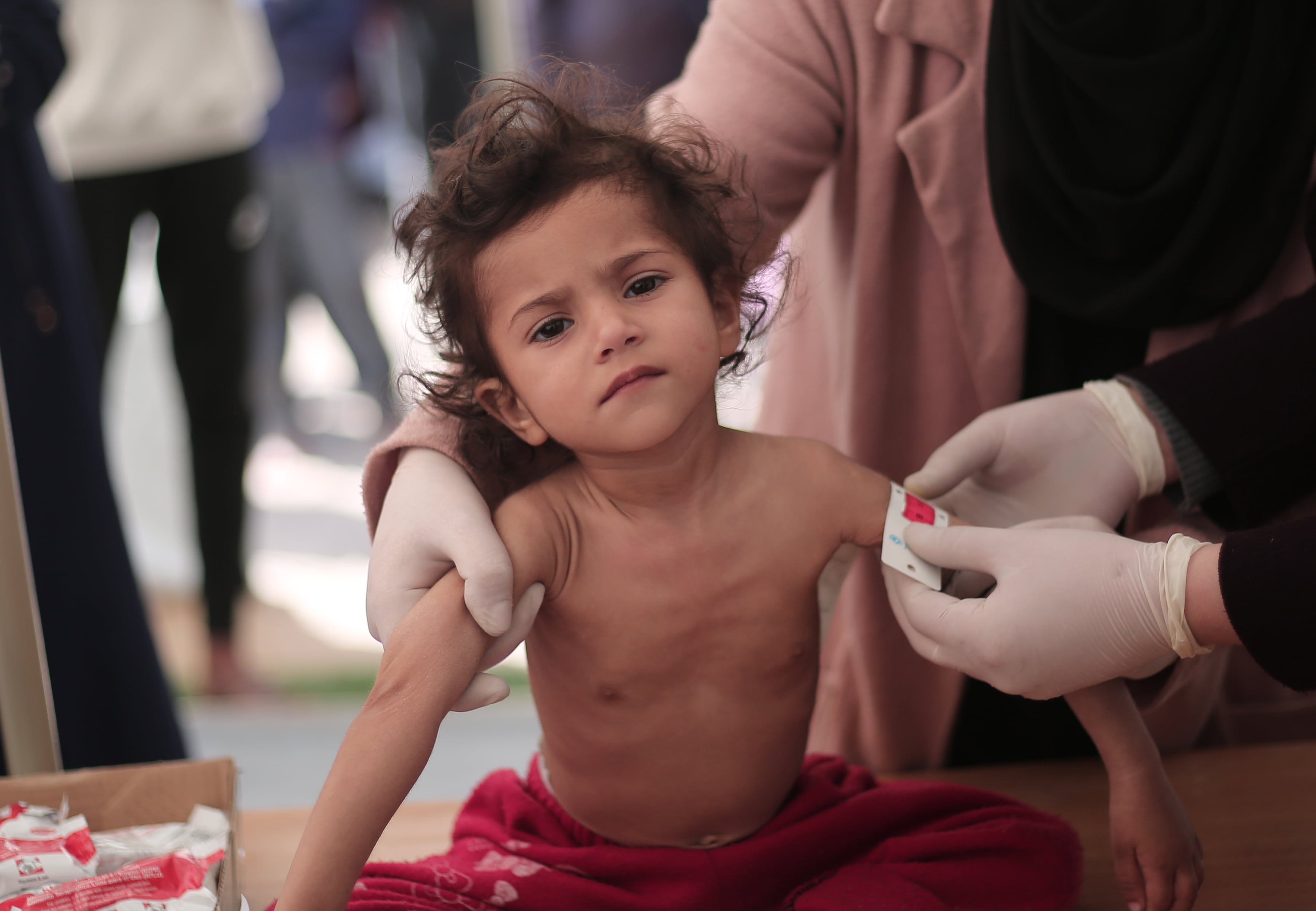 Leen, de 2 años, en el hospital Al-Awda de Gaza